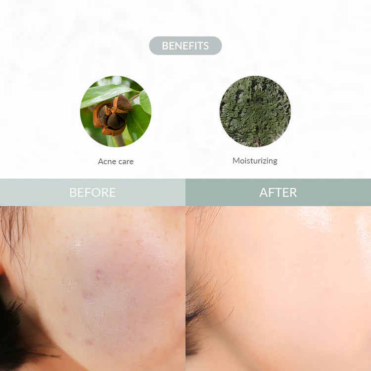 Dr. Althea - Last Minute Skin Rescue Anastatica Mask (30 stk) - Nuaglowdk