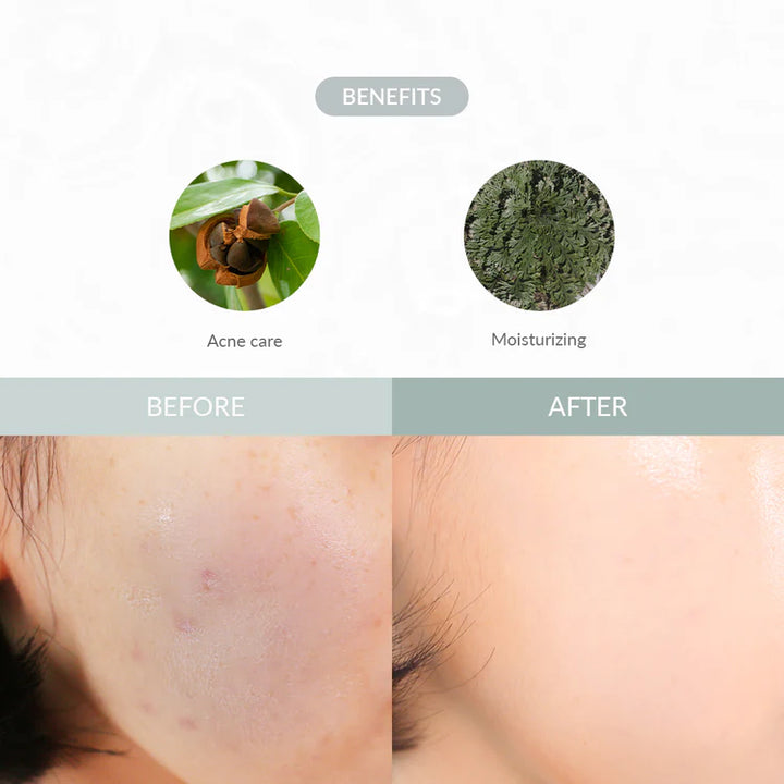 Dr. Althea - Last Minute Skin Rescue Anastatica Mask (30 stk) - Nuaglowdk