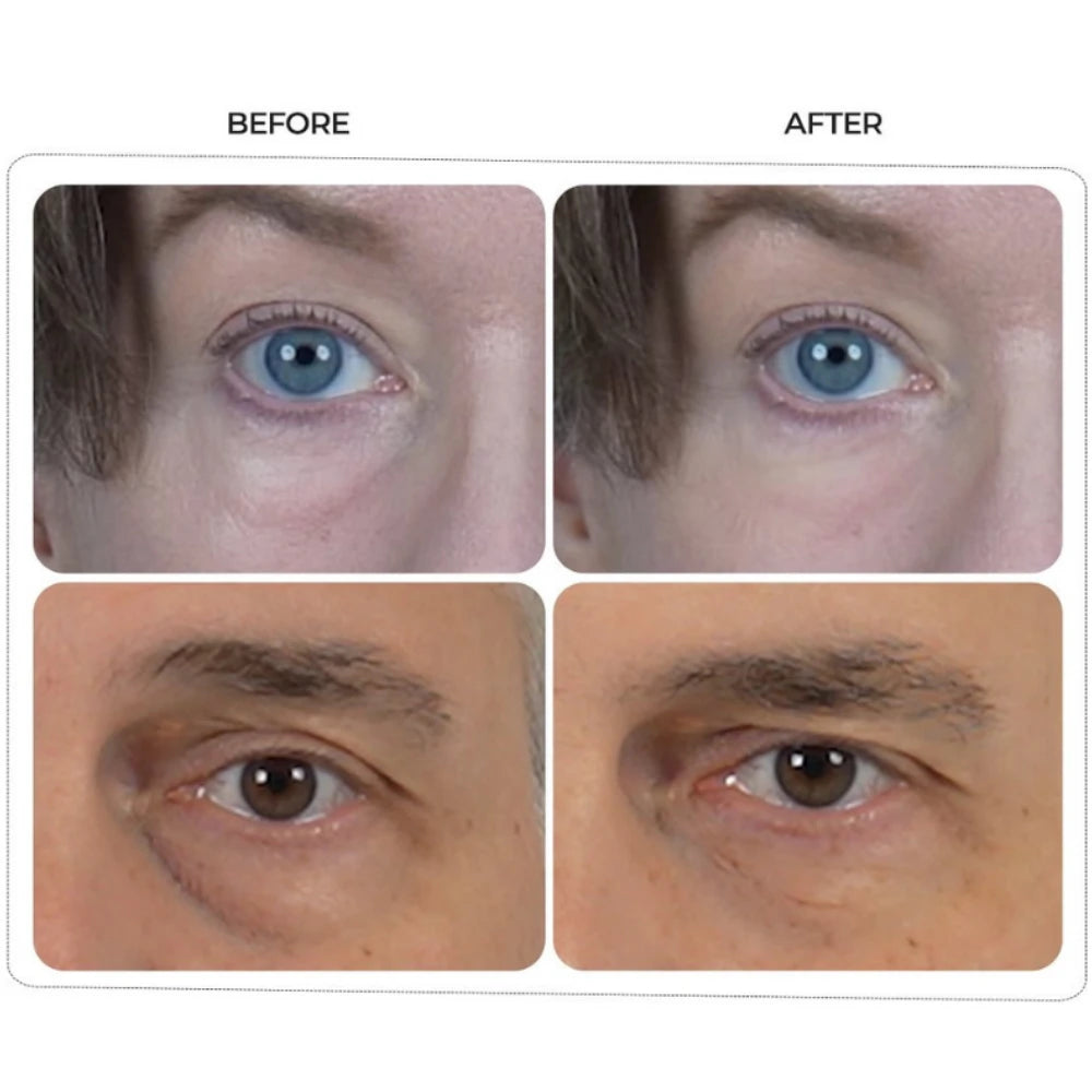 Dr. Melaxin - Eyephalt Eyebag Cream - Nuaglow