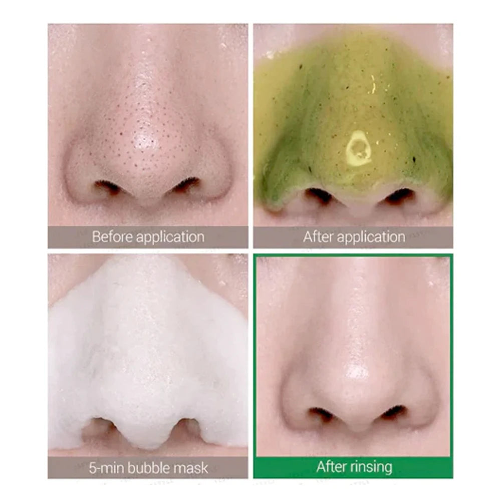 Some By Mi - Bye Bye Blackhead 30 Days Bubble Cleanser (120 ml.) - Nuaglowdk
