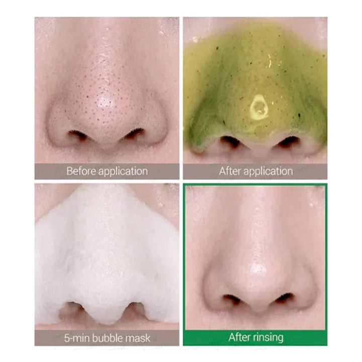Some By Mi - Bye Bye Blackhead 30 Days Bubble Cleanser (120 ml.) - Nuaglowdk