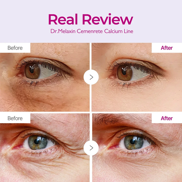 Dr. Melaxin - Cemenrete Calcium Volume Eye Patch (60 stk)